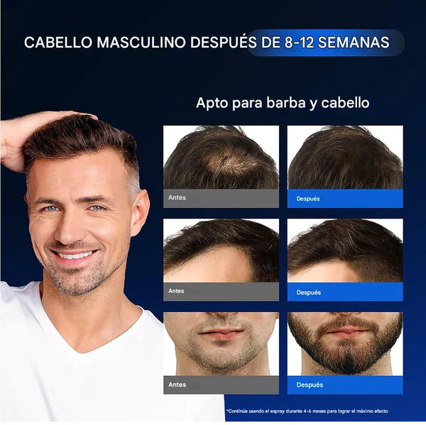 MINOXIDIL Y BIOTINA | AUMENTA EL CRECIMIENTO DEL CABELLO
