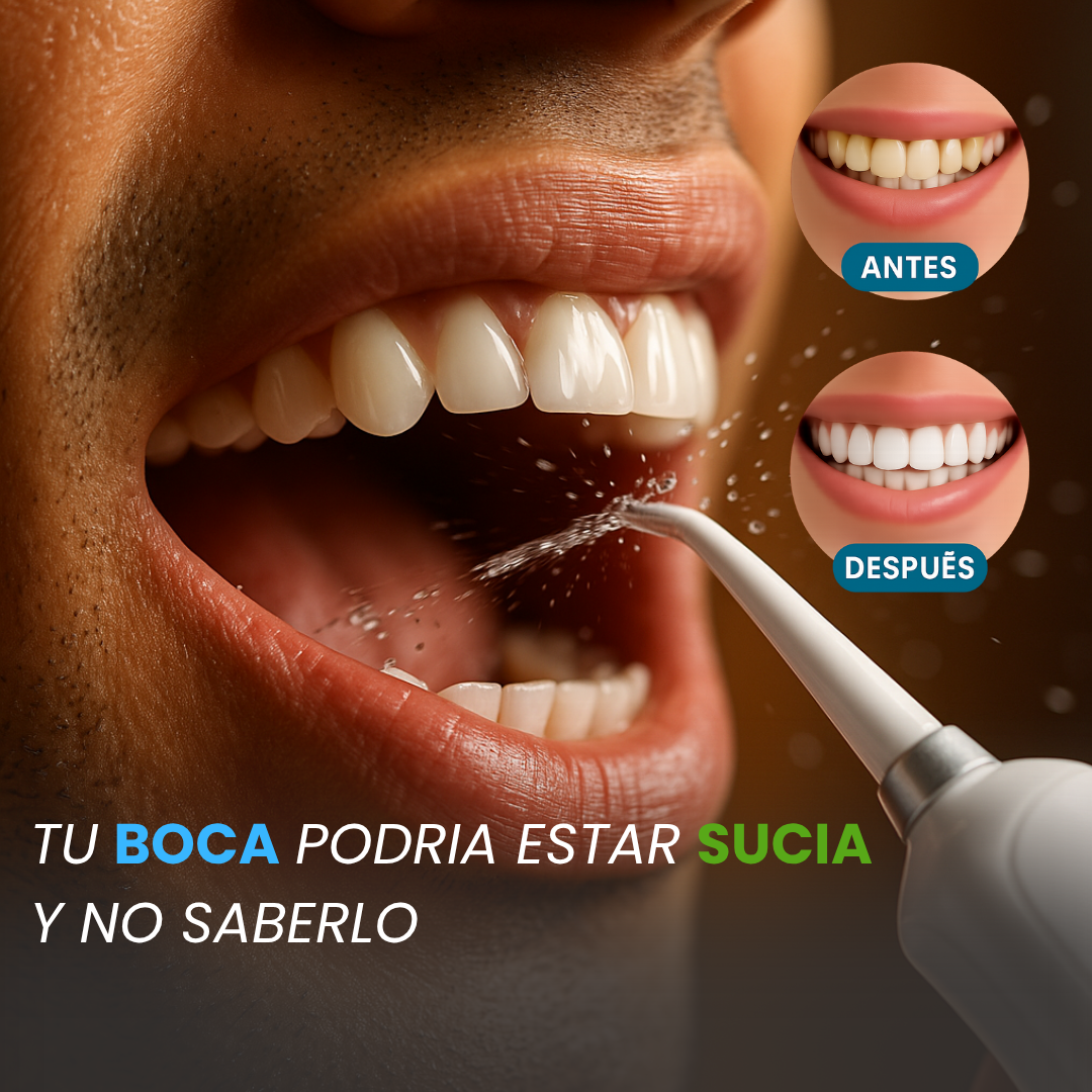💧 Irrigador Dental WaterPro™ 💧 - Capacidad de 300ML V2