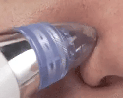 Extractor de impurezas | Belleza Perfecta 22