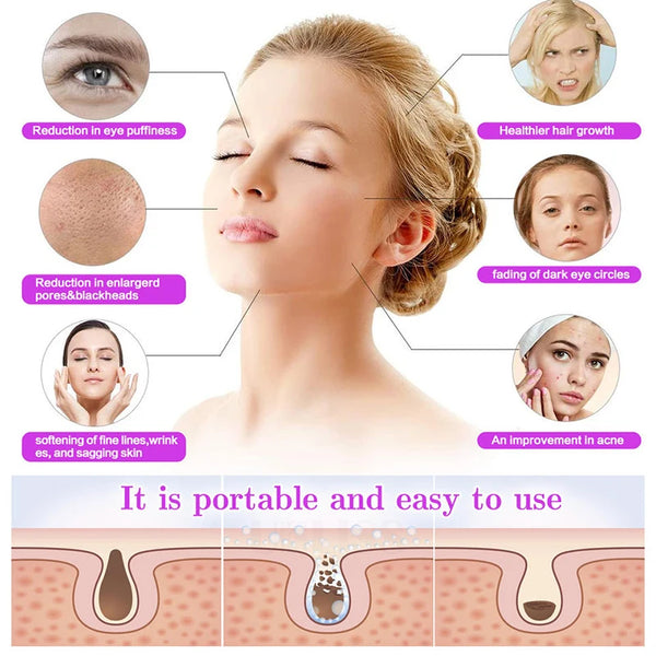 Varita Facial de Alta Frecuencia