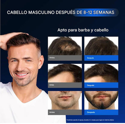 MINOXIDIL Y BIOTINA | AUMENTA EL CRECIMIENTO DEL CABELLO